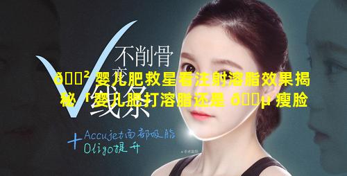 🌲 婴儿肥救星看注射溶脂效果揭秘「婴儿肥打溶脂还是 🐵 瘦脸有什么好方法」